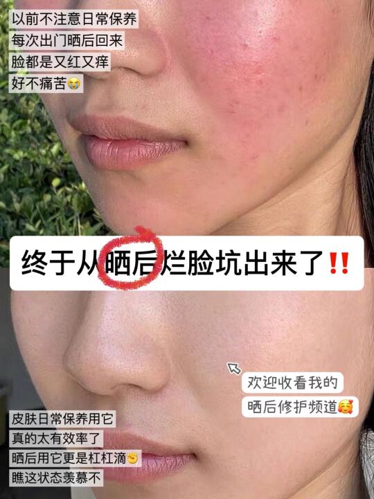 就问！谁能看出我刚春游暴晒回来…