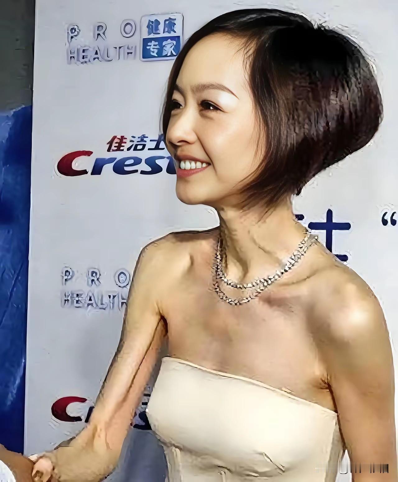 这瘦骨如柴的身材我看到就心理不适，都不敢多看一眼。