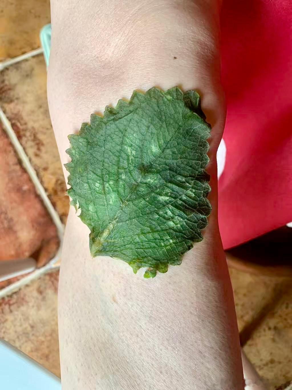 蚂蚁群咬伤臭头厚药，敷太子香。 
