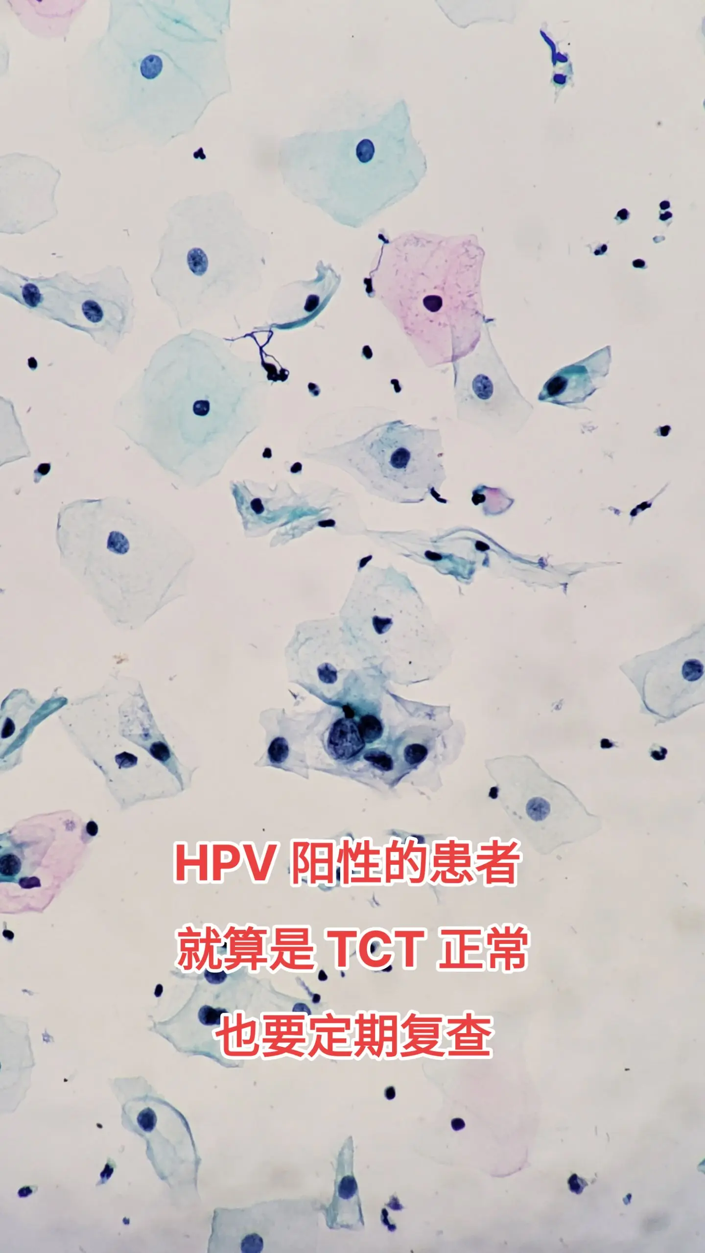 HPV感染