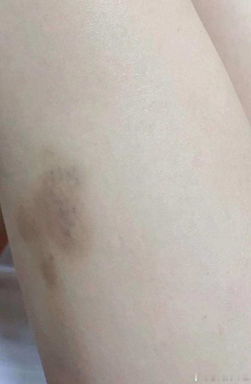 撞哪旮沓了？啊哈哈，你算是撞到金砖啦[太开心]老婆们早呀，早上他来回转悠找眼镜?