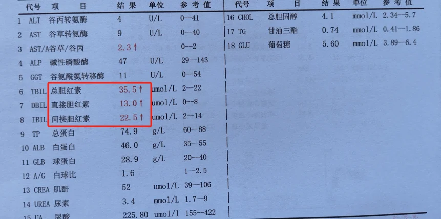 救命！体检单胆红素三项全高，谁懂啊💥 患者焦虑：家人们谁懂啊！刚拿到...