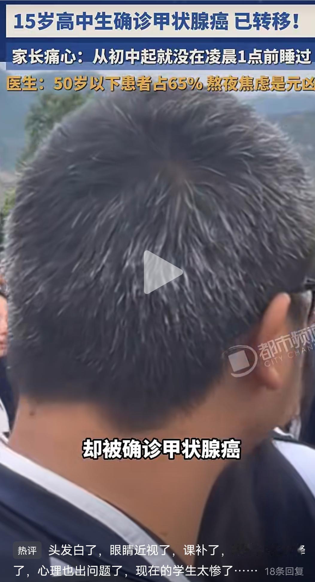 15岁本该是青春有活力的年纪，却被确诊甲状腺癌已淋巴结转移！
医生问起孩子的作息