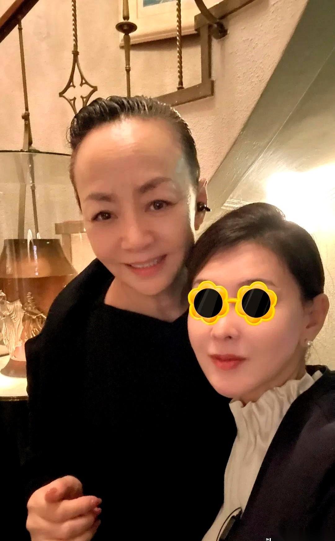 刷到宋丹丹在日本的照片，第一眼，说句大实话，我看到的是她那个光亮的大脑门。
真的