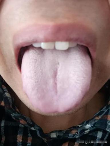 这样的舌头可不单单是，“阳虚” 那么简单[吃瓜群众][吃瓜群众][吃瓜群众]
粉