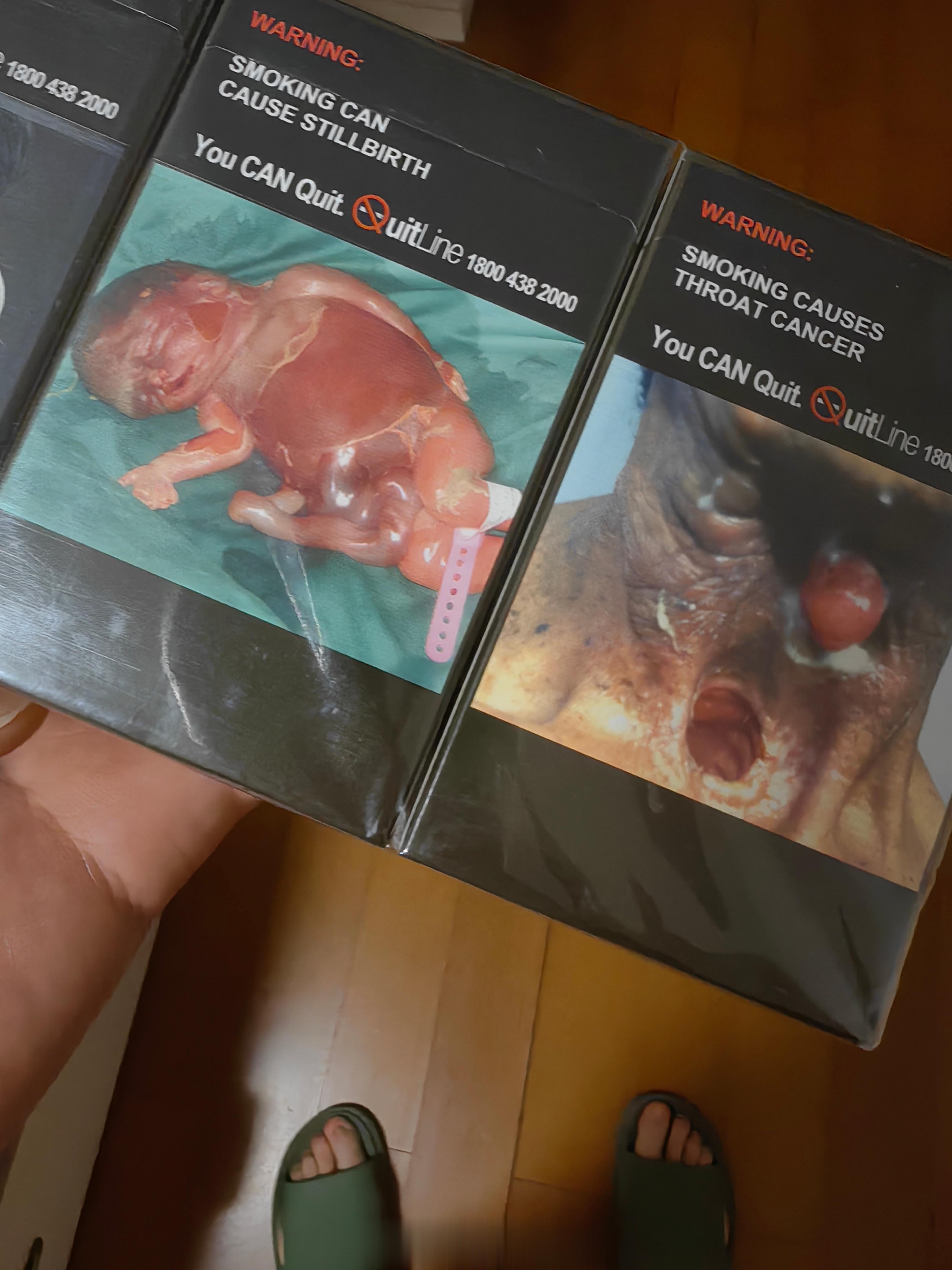 新加坡的朋友回国给我带了一条烟，烟盒的图片吓死我了 ​​​