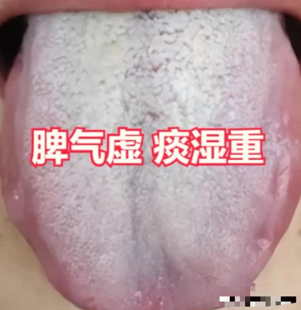 香砂六君丸，正确使用可化痰祛湿，还能有效调理多种常见病症！
或许你们对香砂六君丸