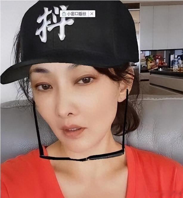 51岁牛莉整容失败 ​​​