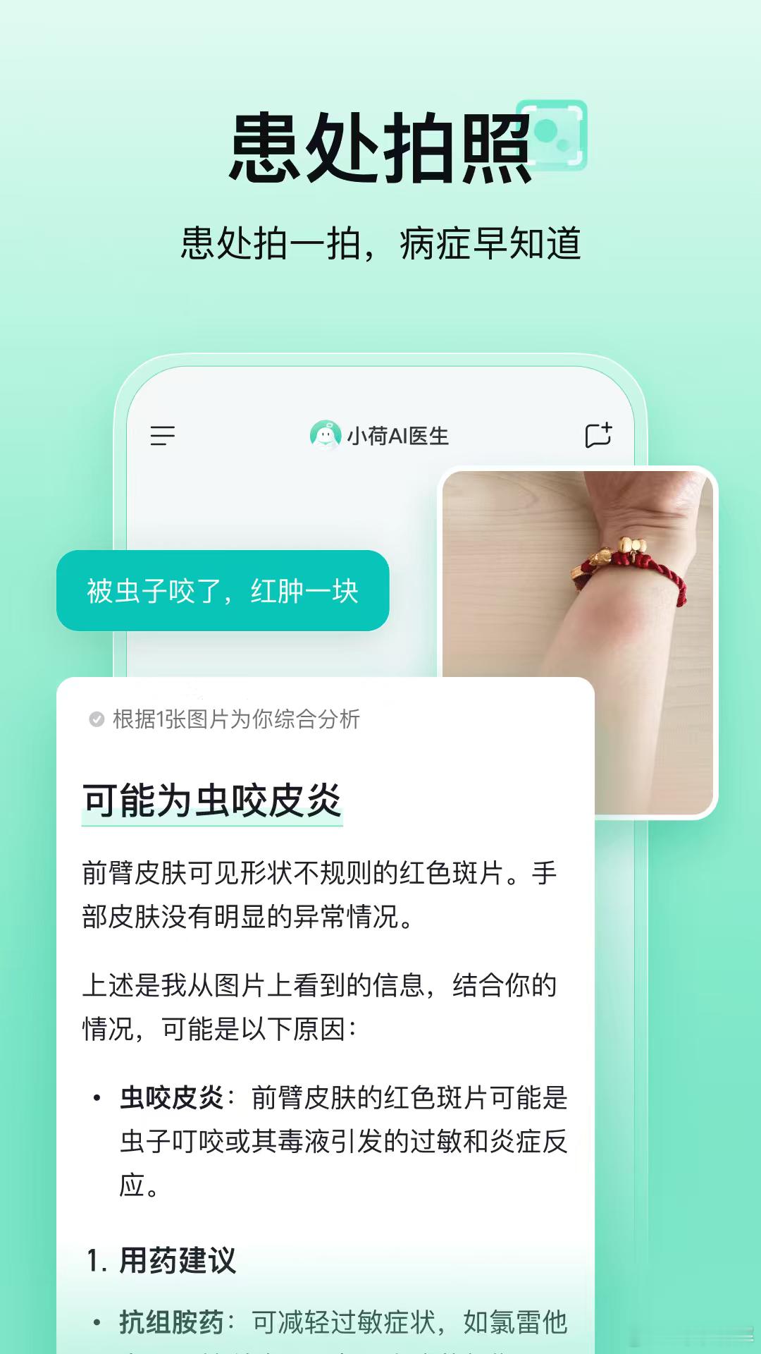 AI医生总结甲型流感症状特点小荷AI医生 小荷AI医生太懂年轻人！不用挂号排队，