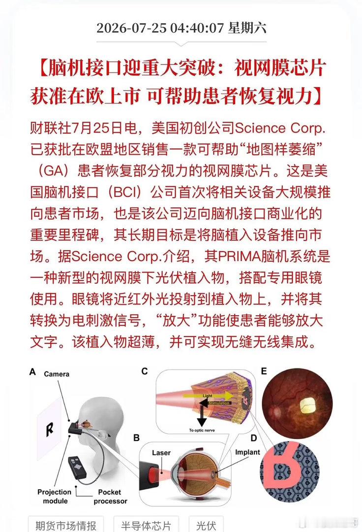 炸了！能让盲人重见光明的芯片，真的上市了！脑机接口要起飞？脑机接口，这次不是概念
