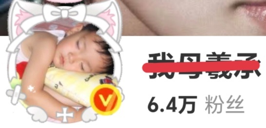 亩亩光顾着给这土小孩美白都忘记鼻孔外翻也需要往里推推了 ​​​