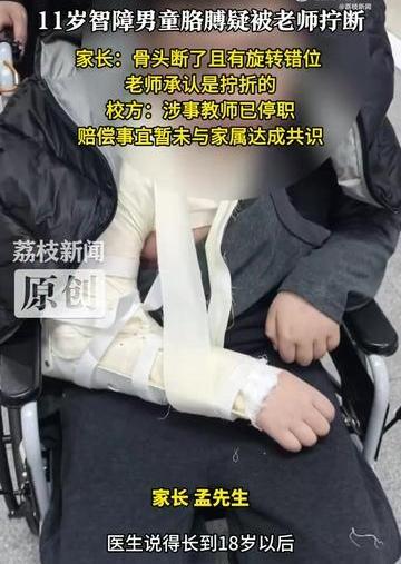 铁岭残校惊现恶行！老师竟拧断11岁智障男童胳膊，这操作我看呆了
 （文章内容仅供