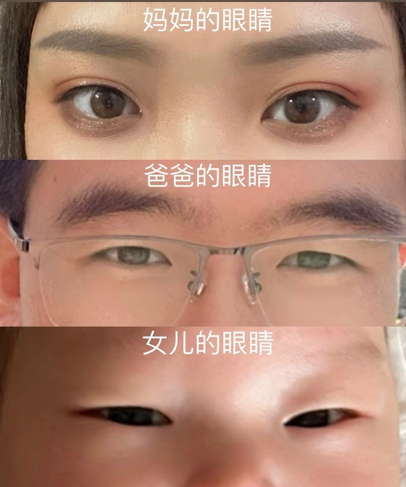 原来大部分女儿都是遗传爸爸了我大眼睛双眼皮，老公小眼睛单眼皮女儿一点没有遗传到我