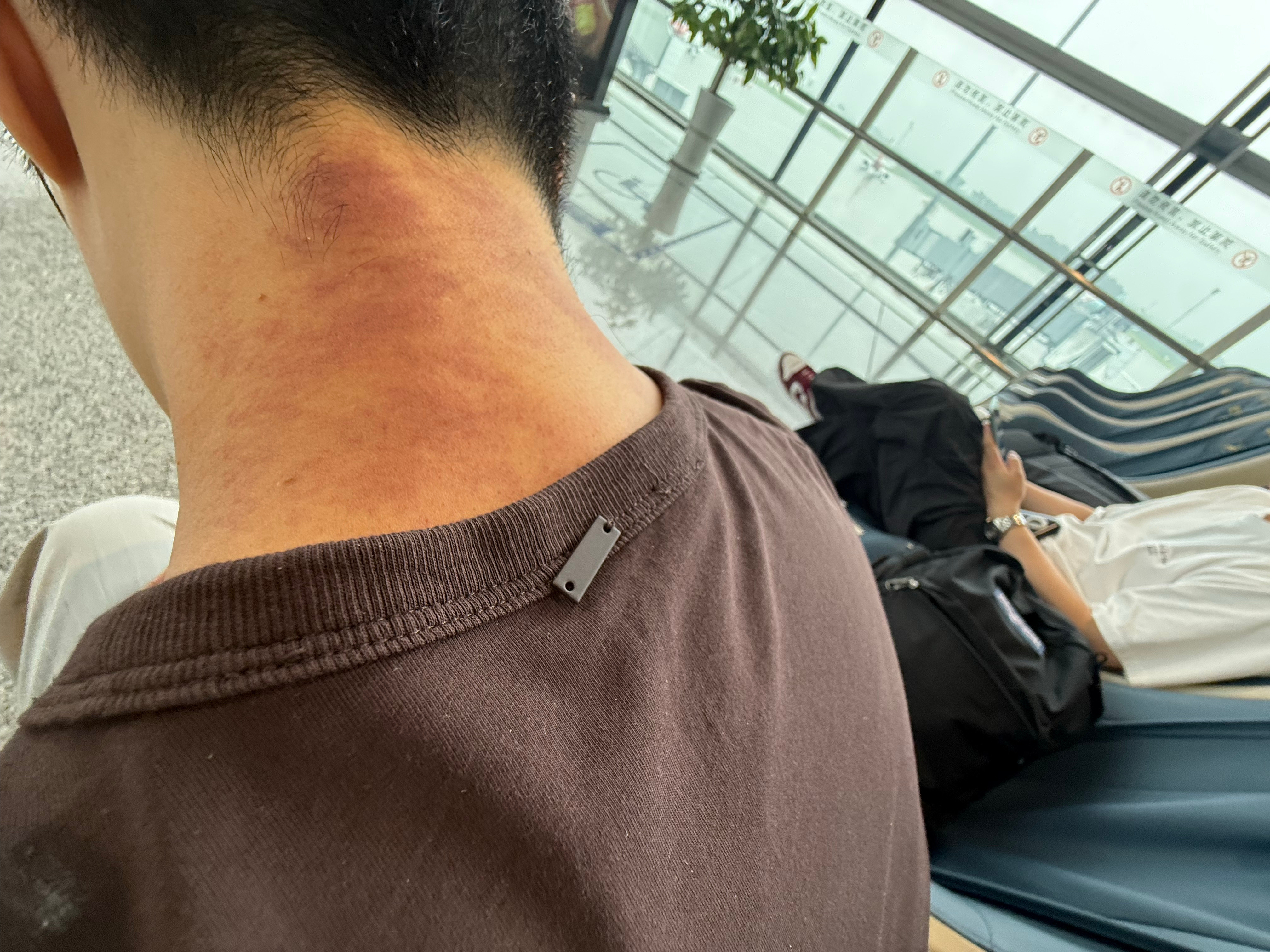 早上艾文看我脖子吓一跳他一直问：你怎么了？怎么了？……怎么脖子都这么严重啊…大姨