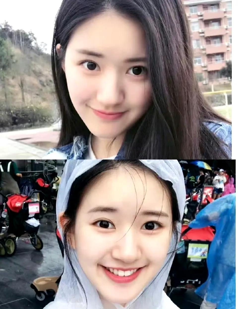 赵露思是我觉得最可惜的一个女孩 ，原先的面相多好，福气满满的元气少女…… ​​​