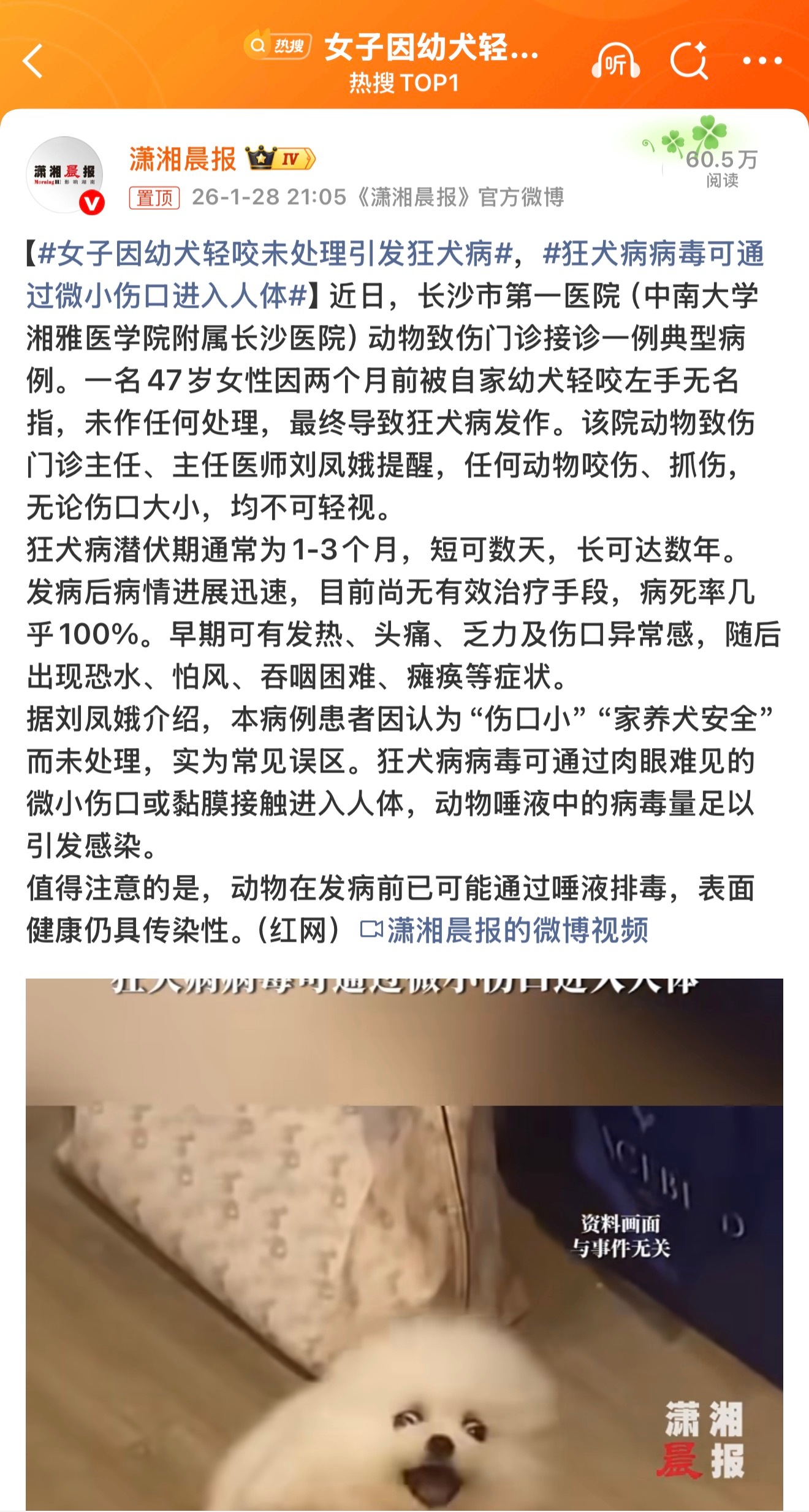 如果是被自家的小狗咬一定要及时就医，因为狗在遛弯的过程很容易接触到携带狂犬病毒的