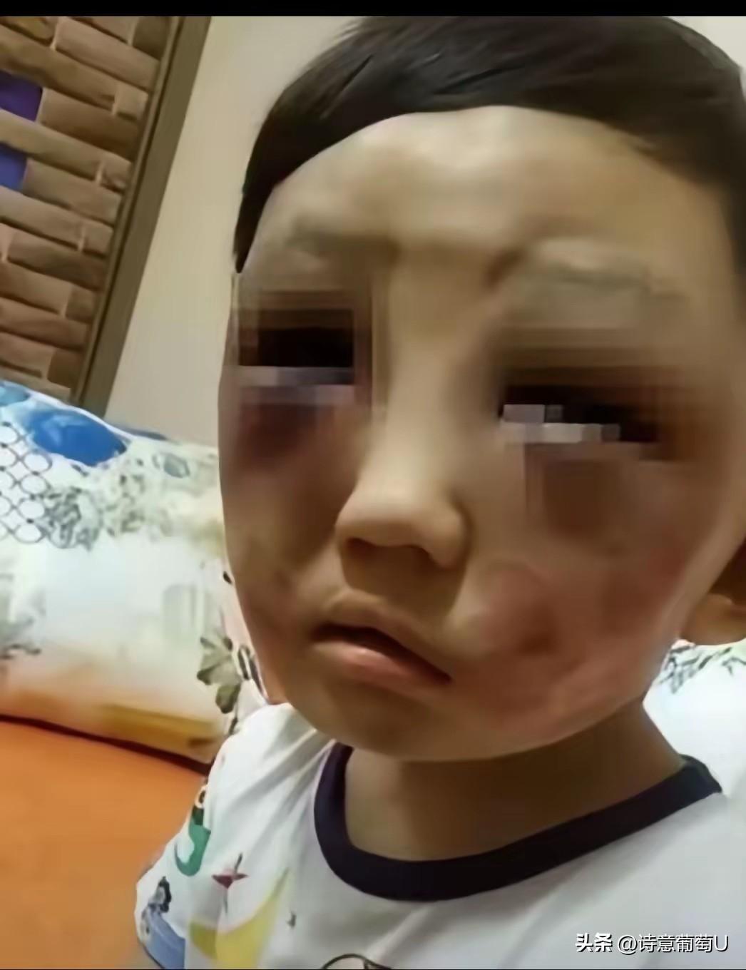 离婚半年，这天早上，6岁的儿子突然冒冒失失地站在妈妈家的门口。孩子身上的衣服脏得