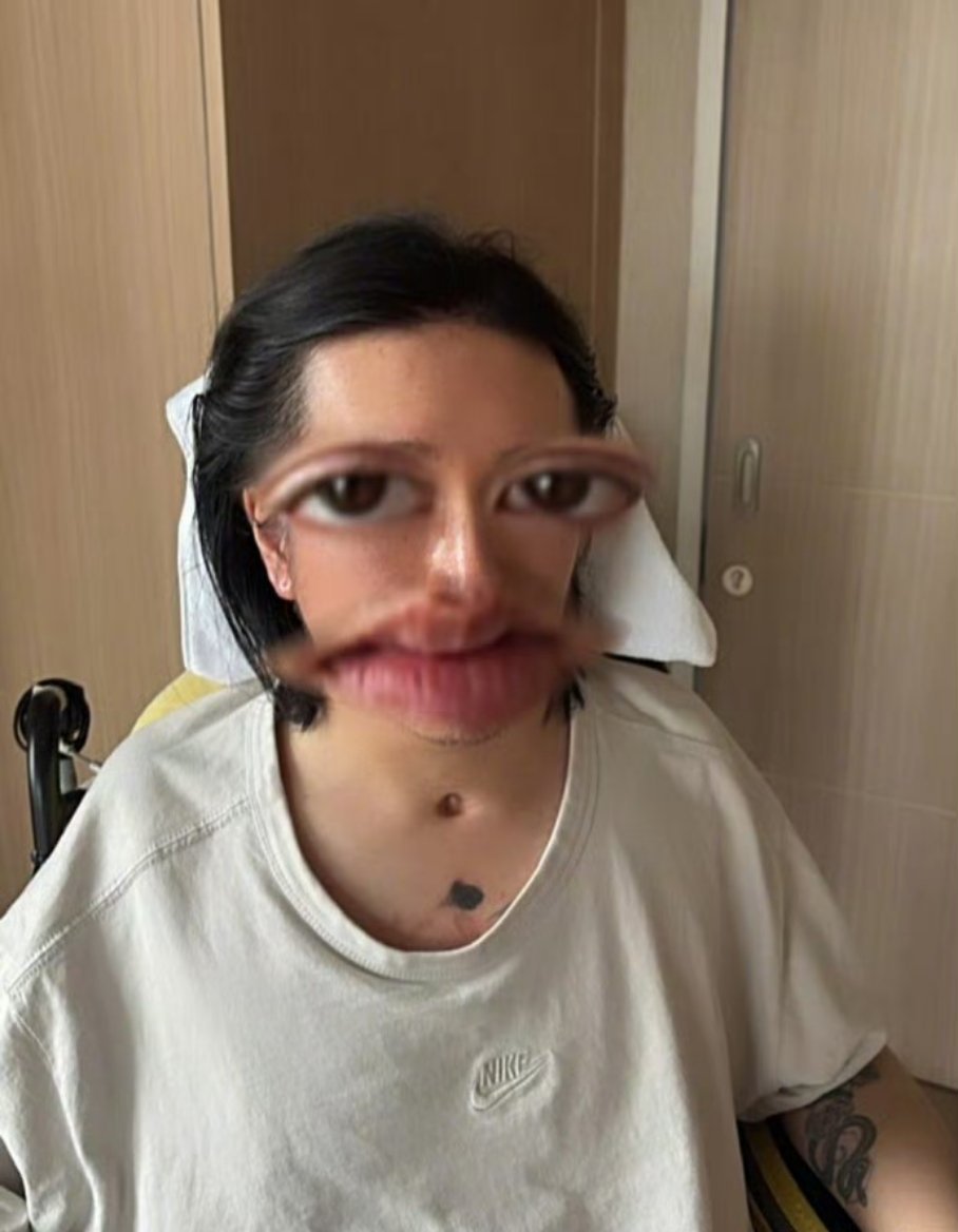 600多万港币的判决，换得来一个年轻人的健全身体吗？换不来！看到 Mirror演