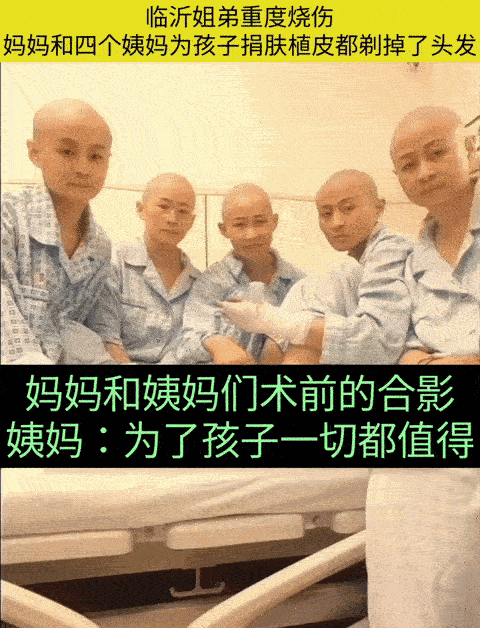 这一家子心真齐，真是血浓于水。
近日临沂姐弟烧伤，妈妈和四个姨妈为了给孩子植皮，