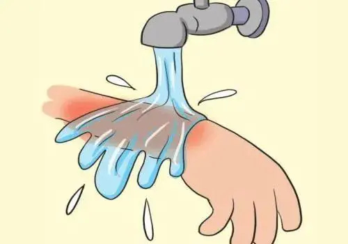 #孩子烫伤9天才送医院爸爸拒绝手术# 不是所有家长都有责任心，都能当一个合格的家