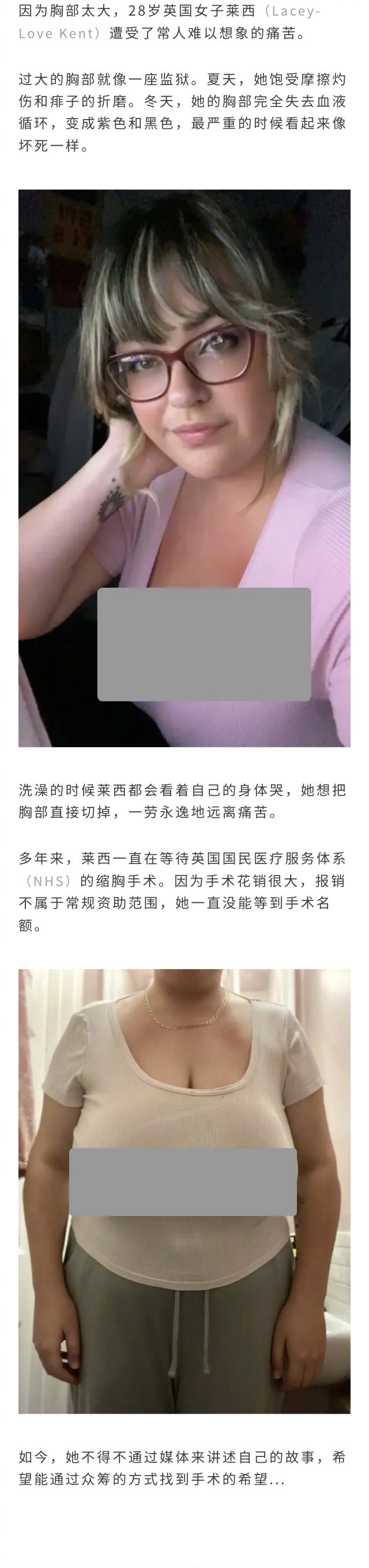 英国女子因胸太大，过于痛苦想直接切掉。最严重的时候被压到走不了路... 