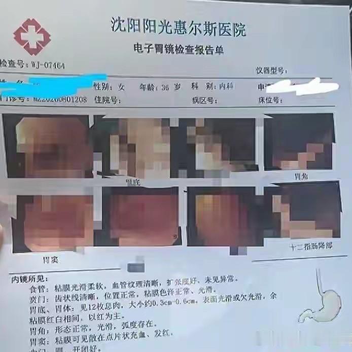 辽宁沈阳，女子去医院胃肠镜检查，迷迷糊糊中，医生把她叫醒，跟她说胃里有12个息肉