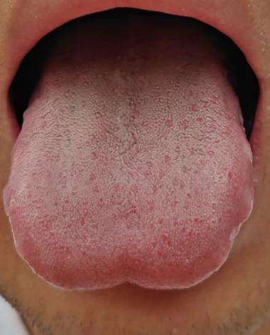 肾精亏虚合并气血亏虚，该如何循序渐进调养？






一位粉丝留言自述：长期精