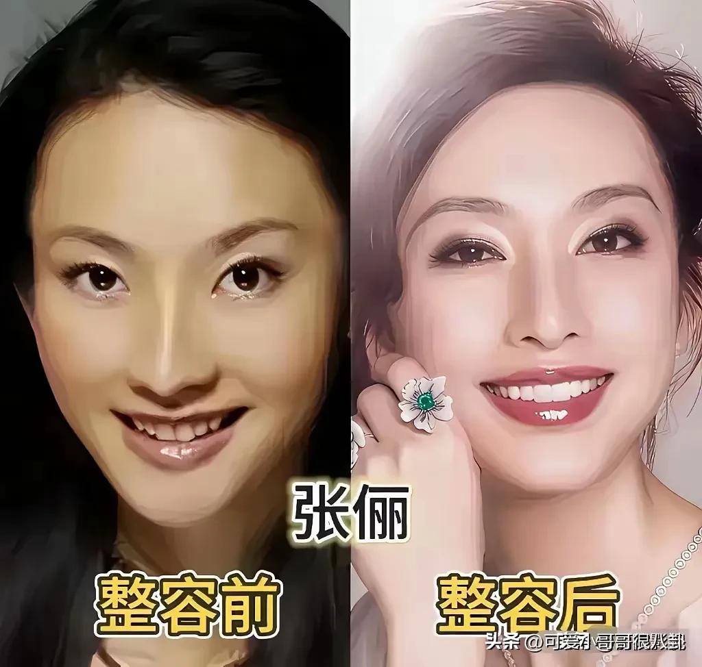 整容整成功，也是一种能力？
这六位女明星都是适度微调，改动不多，颜值气质肉眼可见