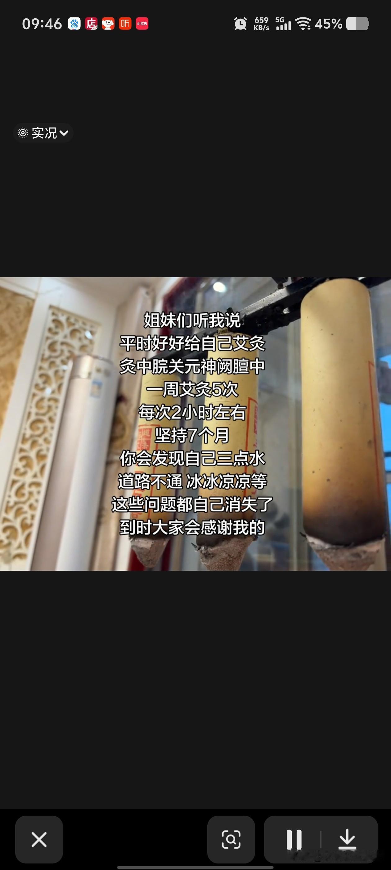 当今艾灸流派，你支持哪一种？
第1个就是三大穴，艾灸，这三个穴位有的就上三年，5