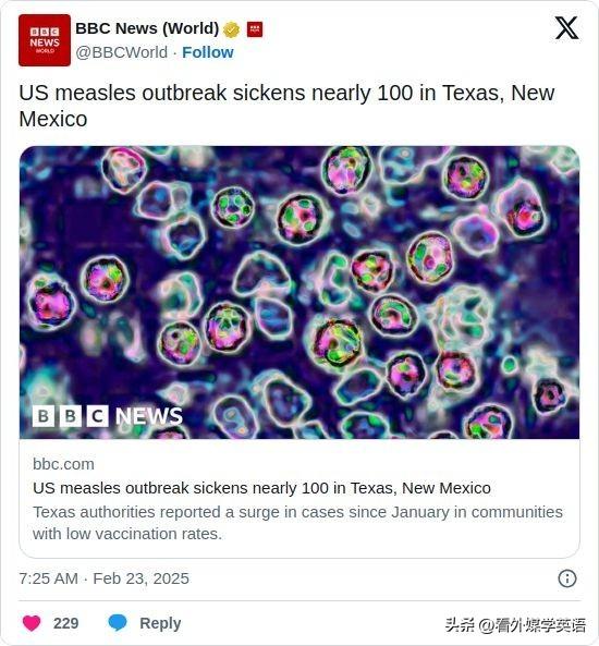 双语简讯：US measles outbreak sickens nearly 