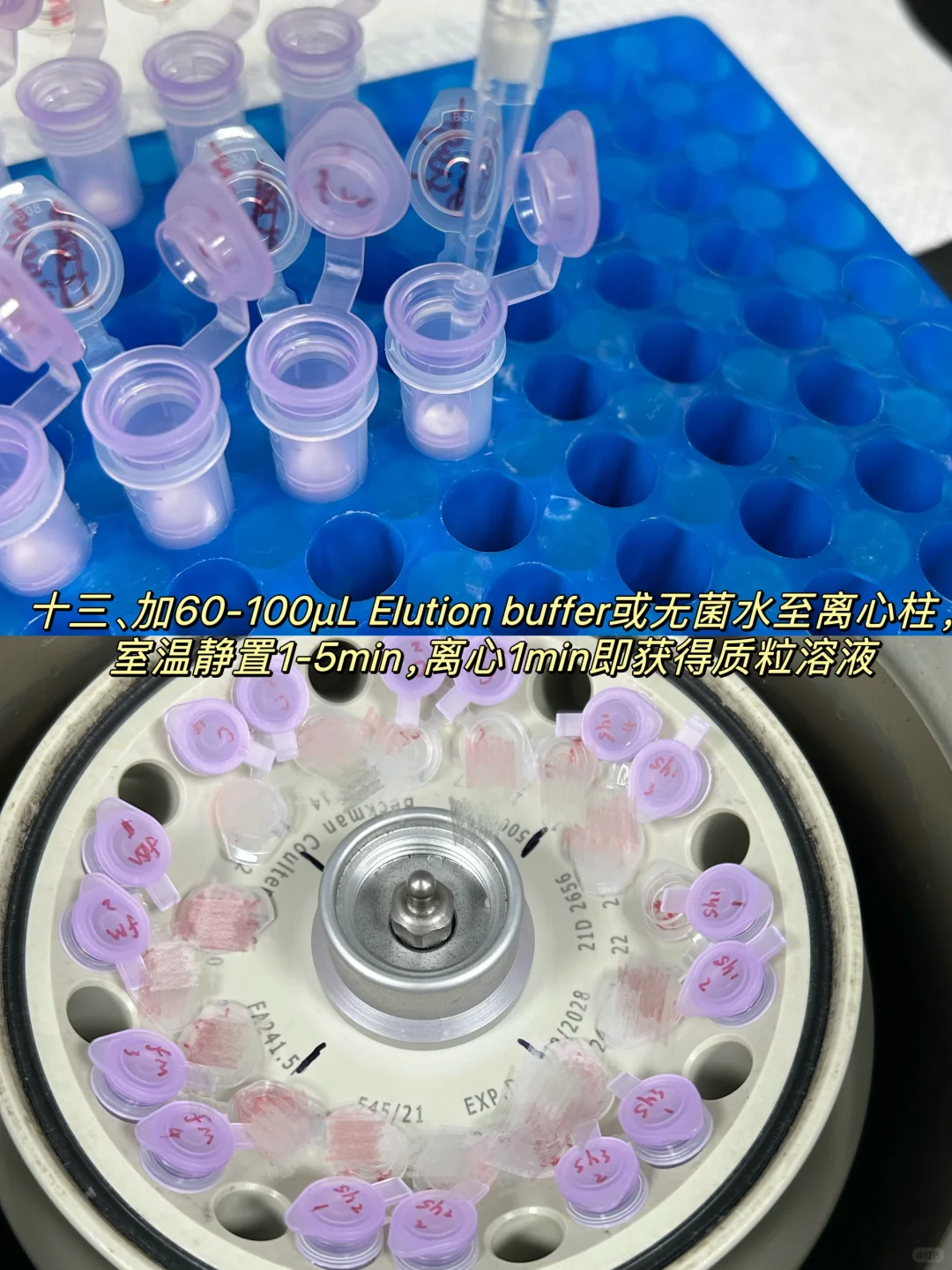 质粒提取超详细教程🤏🏻