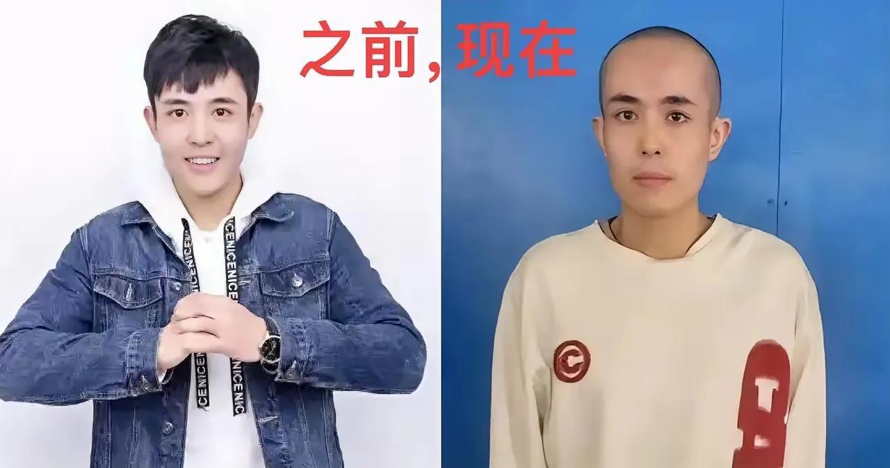 去了缅北，真的整个人状态都不一样了，看了他的腿，满是伤痕累累，说真的，这次没有网