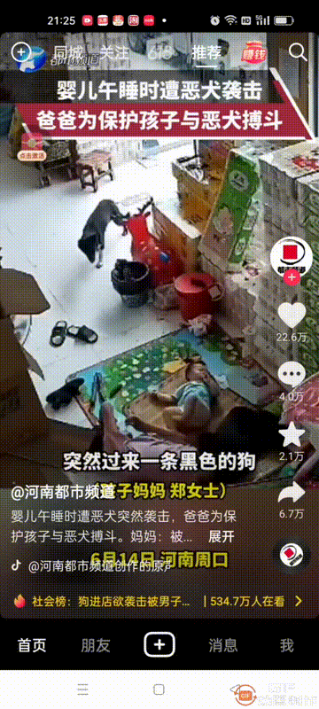 婴儿午睡时遭遇恶犬袭击，
孩子爸爸为保护孩子与恶犬搏斗
真的太惊险了，还好有爸爸