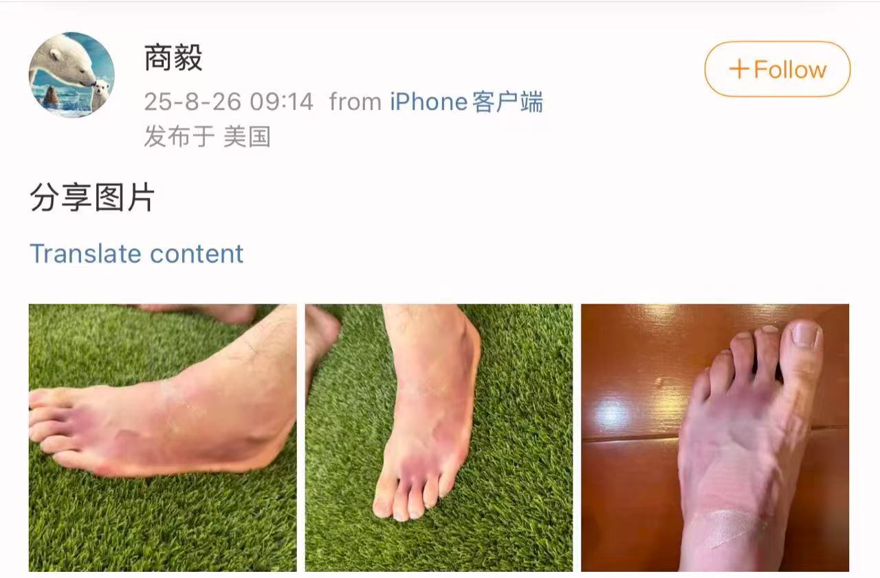 亿点点心疼😣 有一个说法，网球是比脚步的，不是比手的。大概意思就是，移动到位是