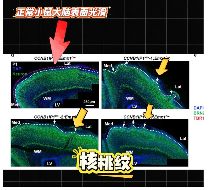 小鼠长出类似人脑褶皱！中国科学家找到人类超高智力关键基因