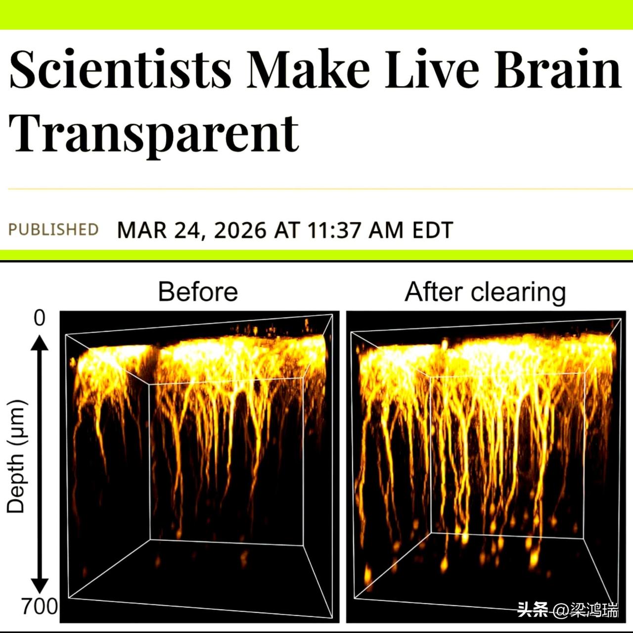 日本科学家刚刚使活体大脑暂时透明化，而没有对其造成损伤。

日本九州大学（Kyu