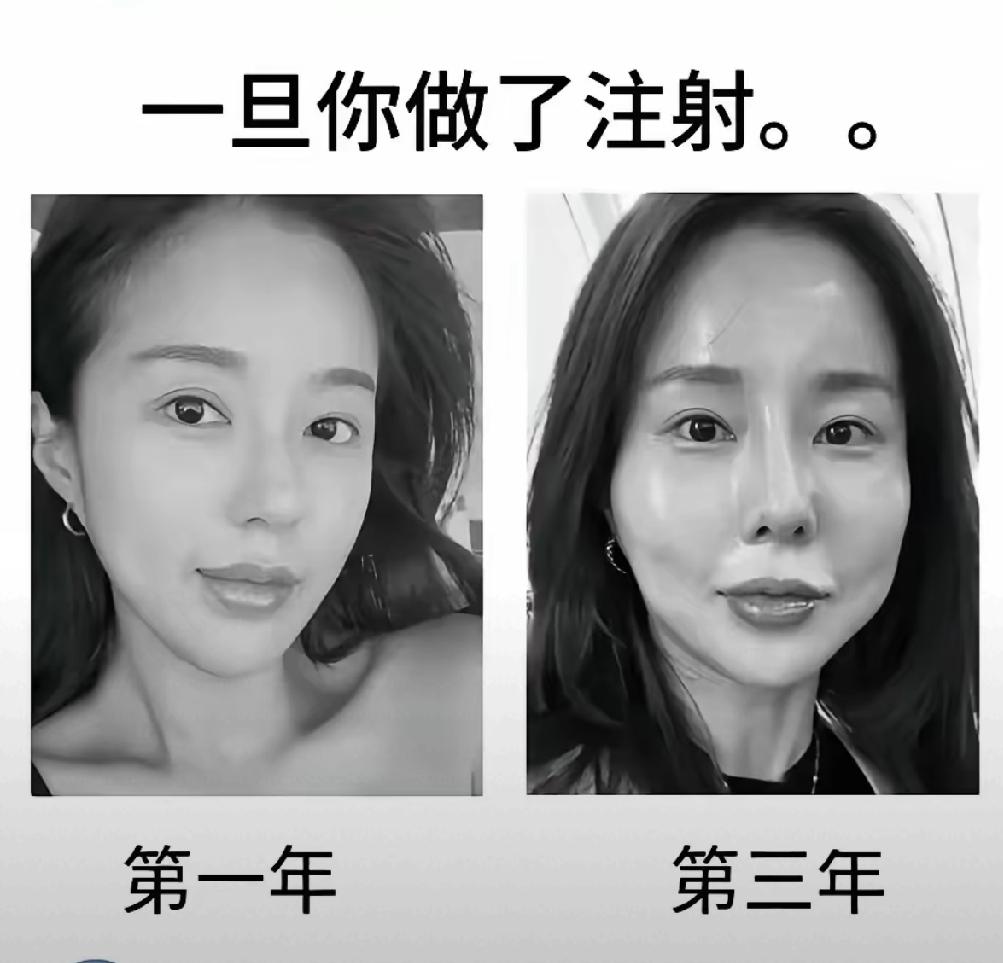 不明白为什么女性要花钱毁容？医美爽三天，后悔三十年，美容打针要慎重。每回都见到很