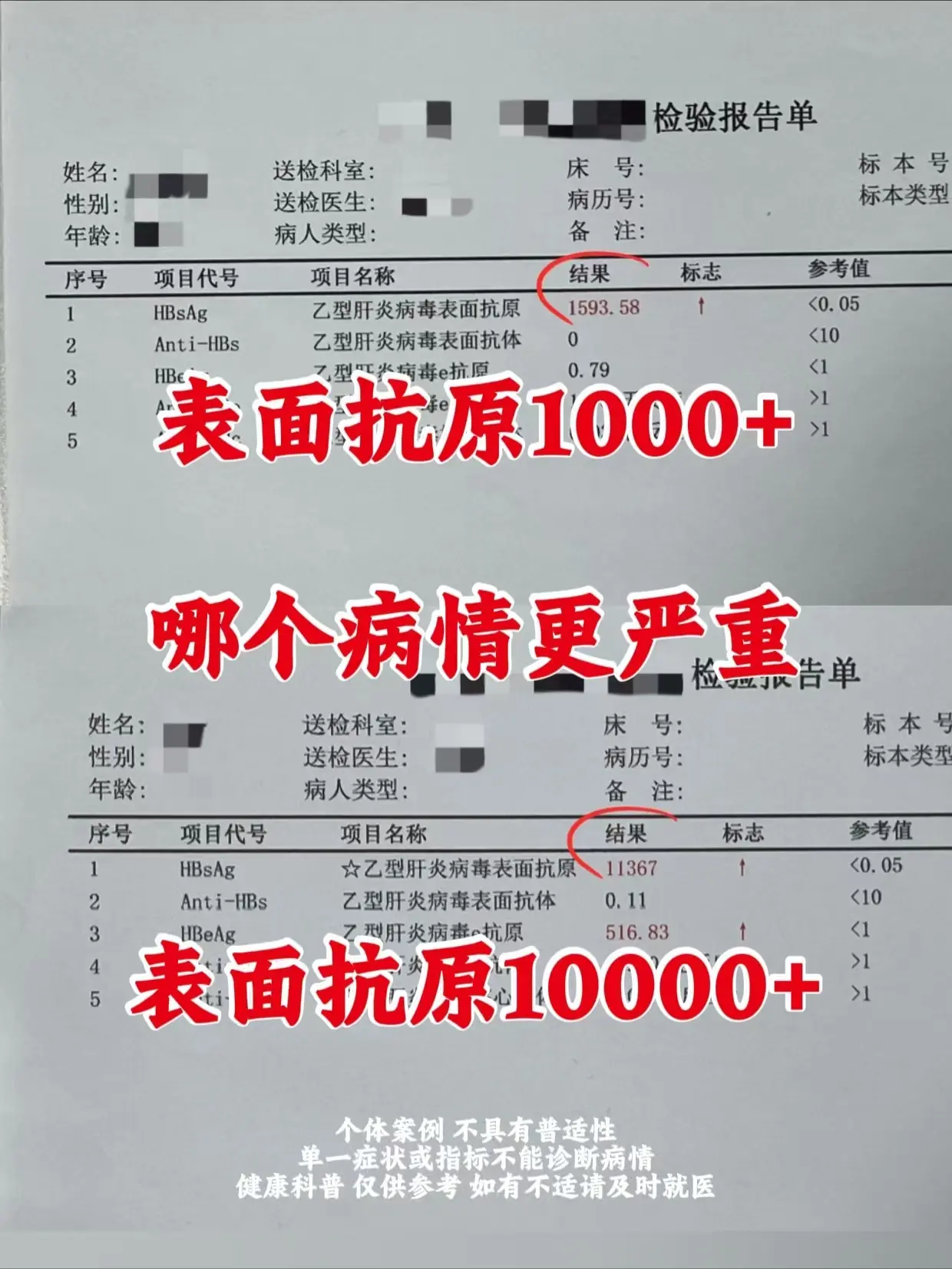 患者咨询：我的表面抗原10000多，我母亲的表面抗原是1000多，这是...