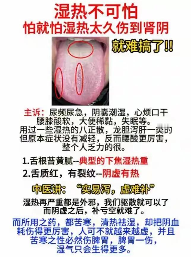 湿热与肾阴的微妙关系，你了解多少？看看你的舌苔就知道了！#湿热在肝胆# #中医你
