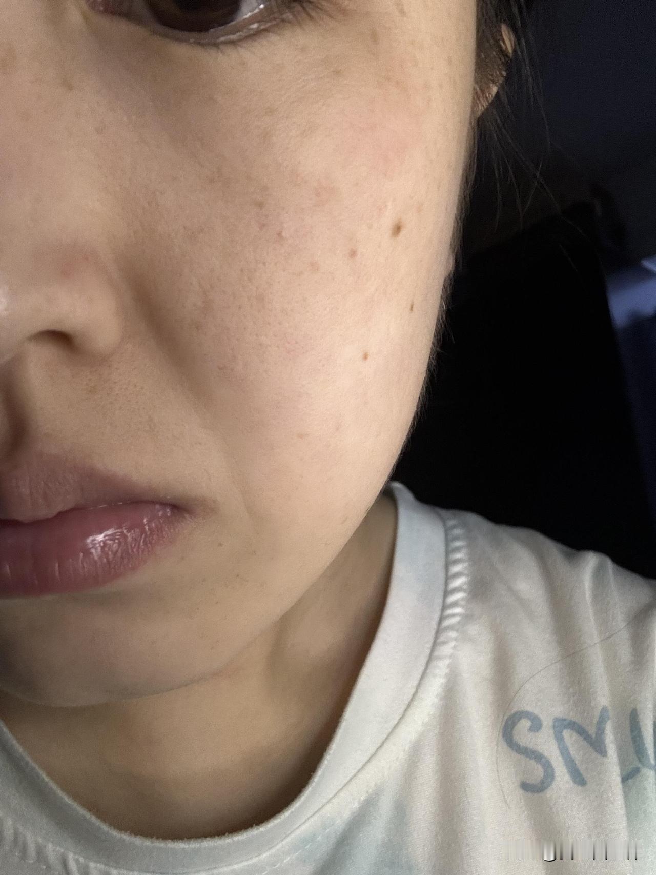 广大网友：垮脸到底应该怎么救？
每天看着镜子里脸垮的样子真的很焦虑，生活习惯不规