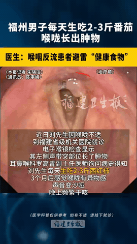 “吃出悲剧了！”福建福州，一60岁男子突然出现剧烈咳嗽，起初还觉得是感冒了，可后