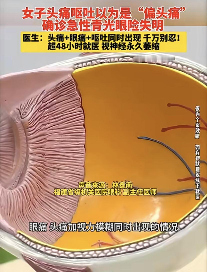 吓人!女子头痛呕吐以为是偏头痛，一查竟是青光眼，医生：超过48小时就晚了
很多人