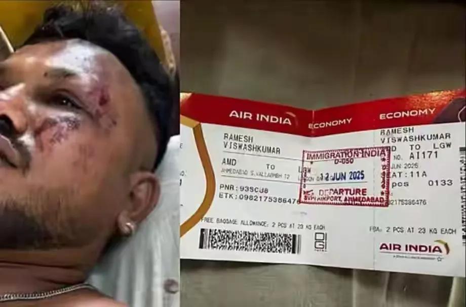 这位兄弟确实是命大，甚至可以说是捡回了一条命，在这个发生空难死亡率几乎100%的