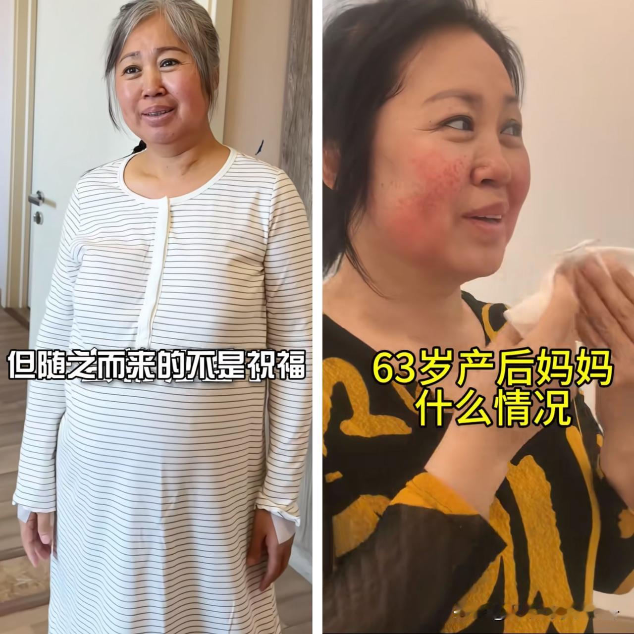 63岁执意生二胎，如今后悔不已。

王女士又新做了美容，月子里就染了头发，以为让