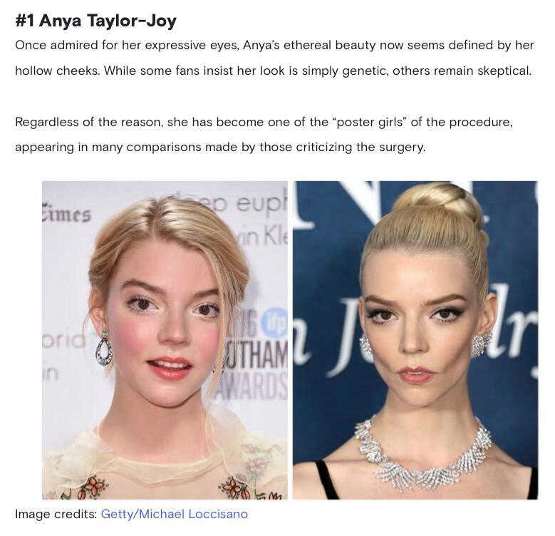 好莱坞现在流行的“刀削脸”盘点 跨年电影愿