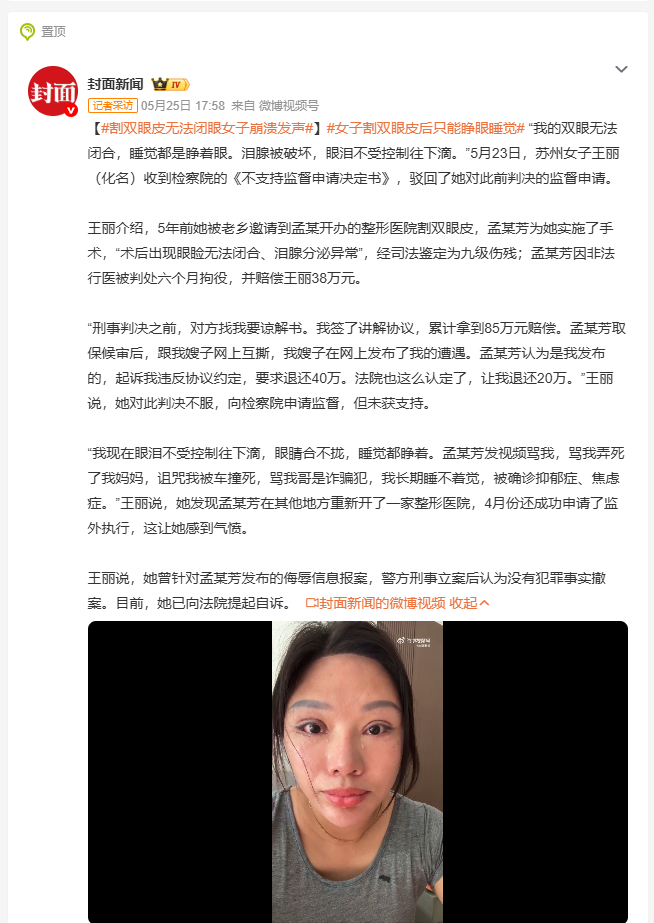 割双眼皮无法闭眼女子崩溃发声 5月23日，苏州女子王丽收到检察院不支持监督申请决