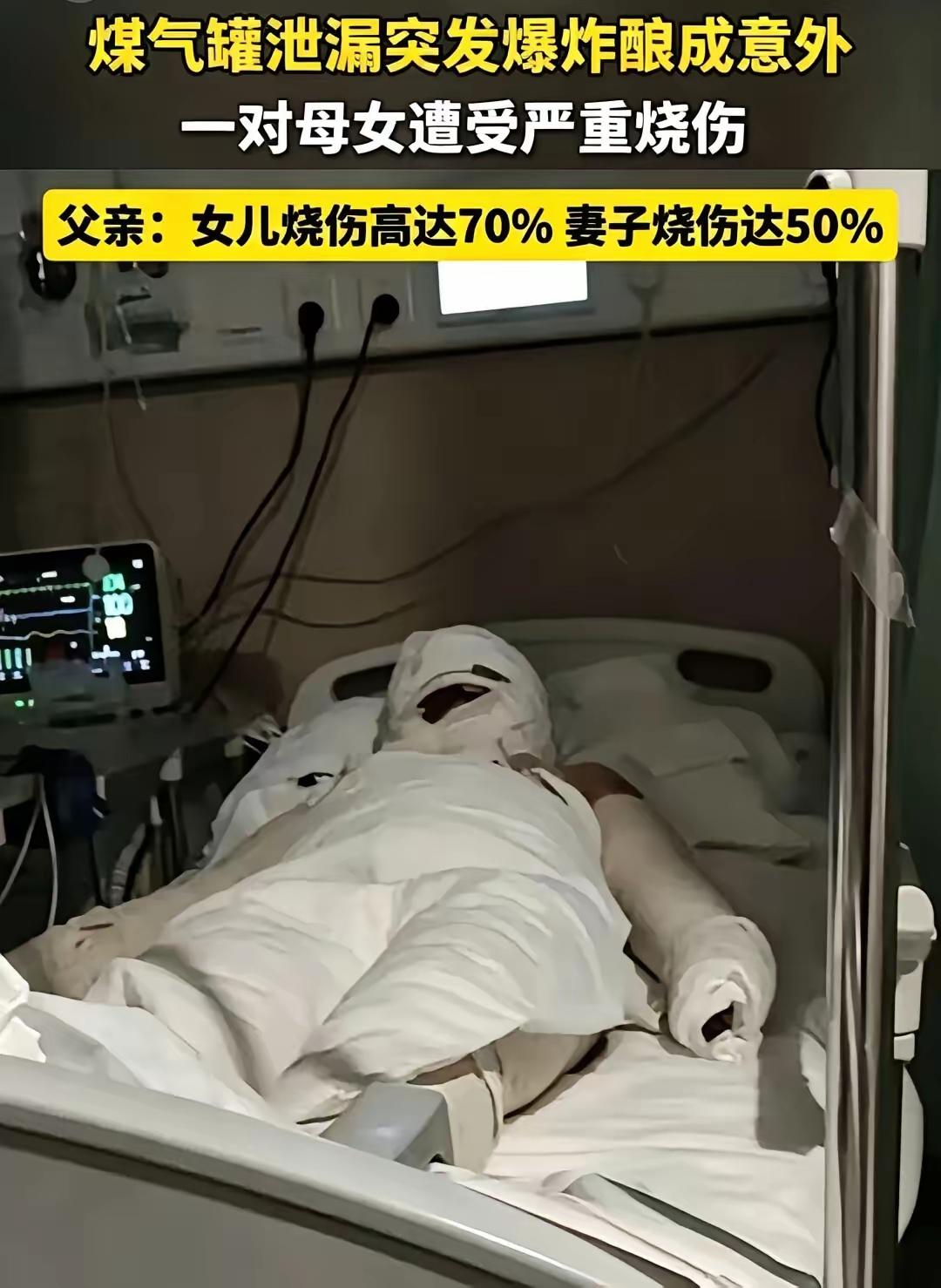 好好的家瞬间被爆炸摧毁，泰安母女遭遇燃气意外后的伤情，看完心里久久没法平静。

