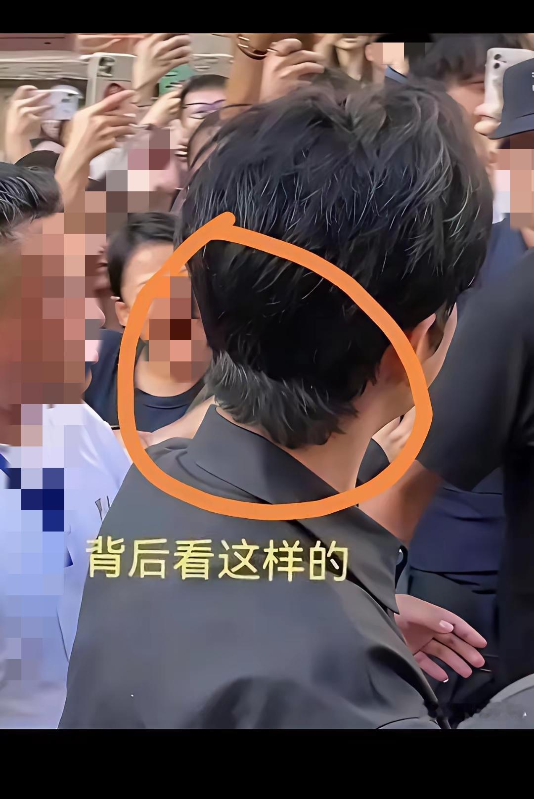 名人最实锤的假发！相当于底裤漏了。