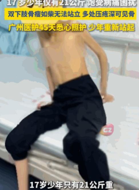 悲剧还是发生了！江西，一17岁少年，六年来反复呕吐、无法进食，身高150厘米的他