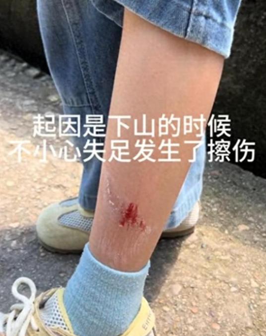 江西龟峰这事儿真的看懵全网！五一假期宝妈带女儿爬山，孩子腿不小心刮破受伤，情急之